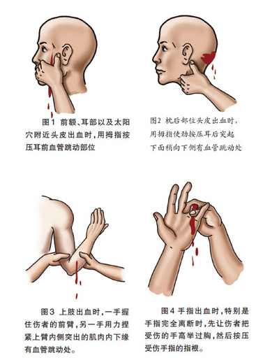 清創(chuàng)縫合換藥包 